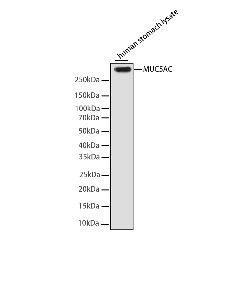 Rabbit monoclonal antibody