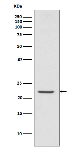 Rabbit monoclonal antibody