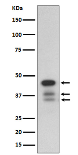 Rabbit monoclonal antibody