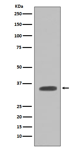 Rabbit monoclonal antibody