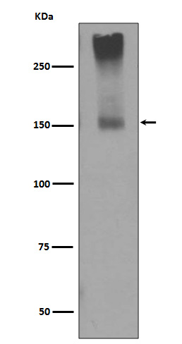 Rabbit monoclonal antibody