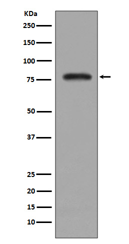 PKC beta 2  Rabbit mAb