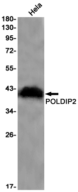Rabbit monoclonal antibody