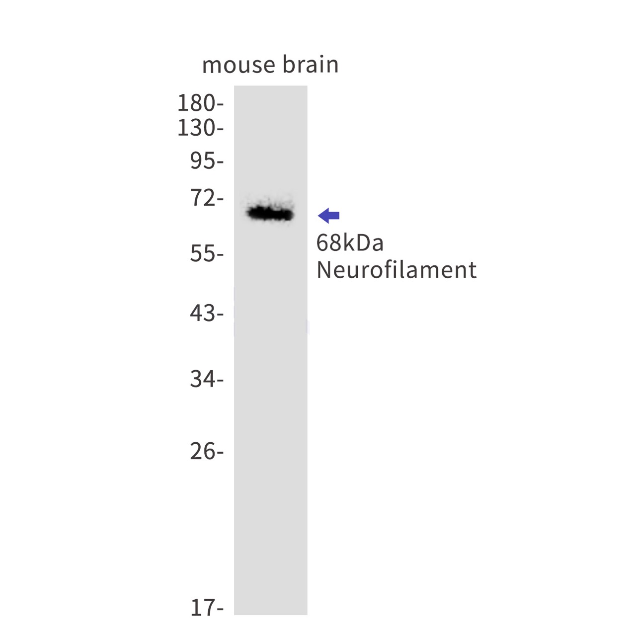 Rabbit monoclonal antibody