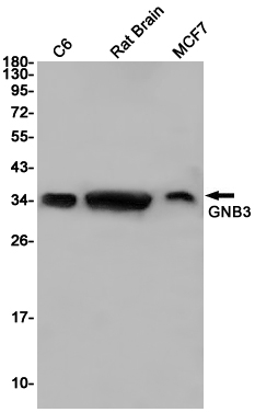 Rabbit monoclonal antibody