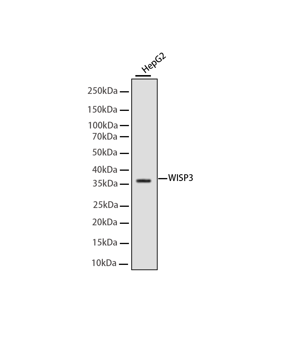 Rabbit monoclonal antibody