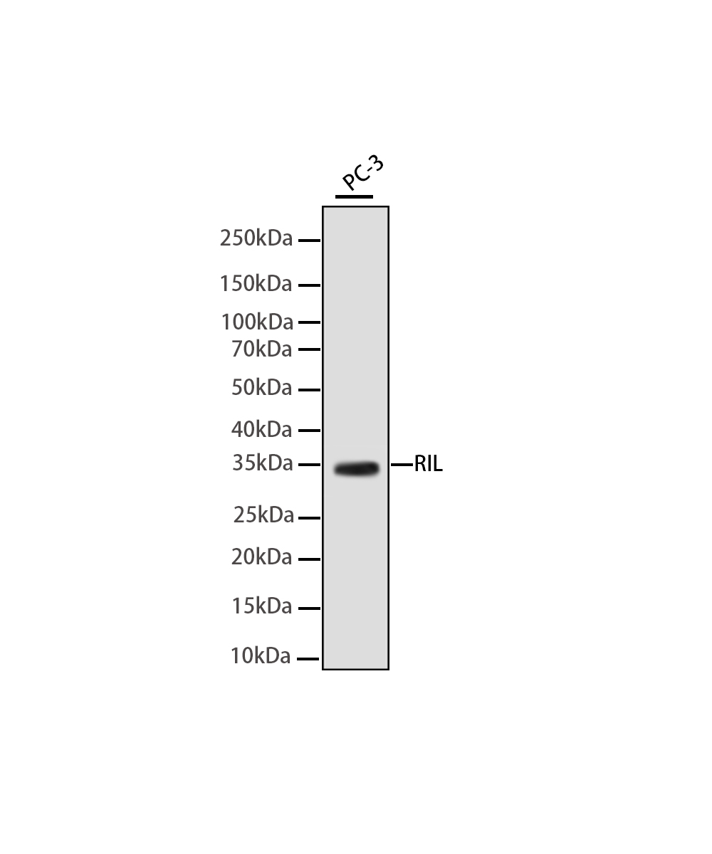 Rabbit monoclonal antibody