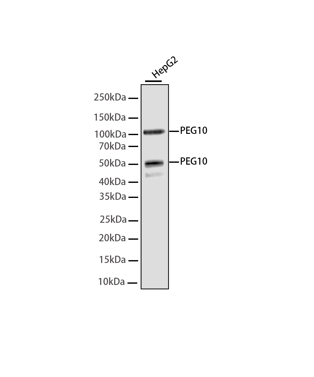 Rabbit monoclonal antibody