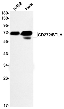 Rabbit monoclonal antibody