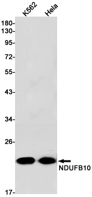 Rabbit monoclonal antibody