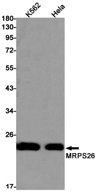 Rabbit monoclonal antibody