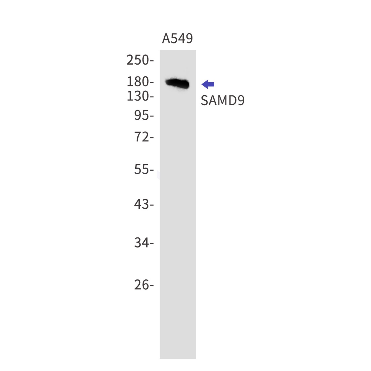 Rabbit monoclonal antibody