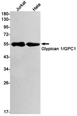 Rabbit monoclonal antibody