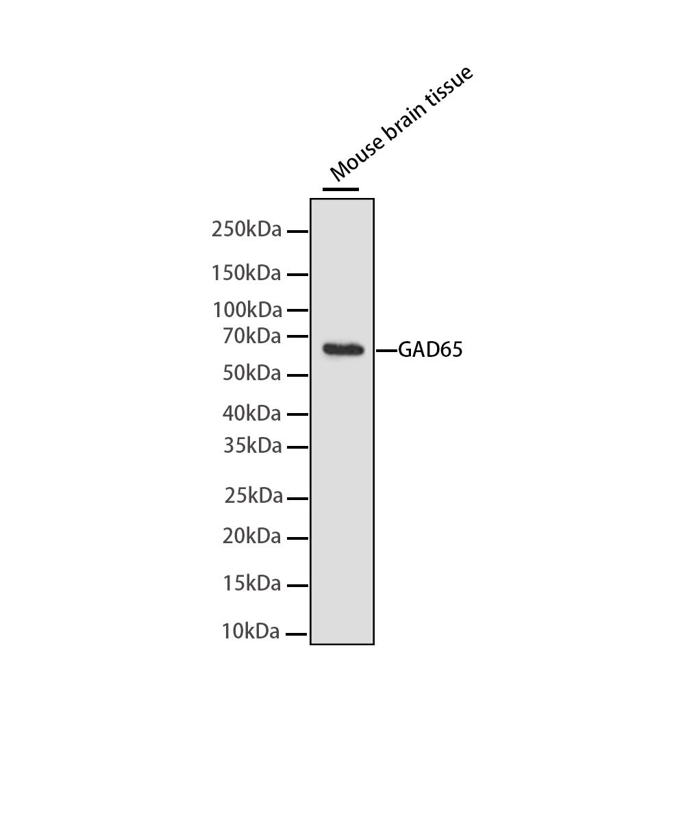GAD65 Rabbit mAb