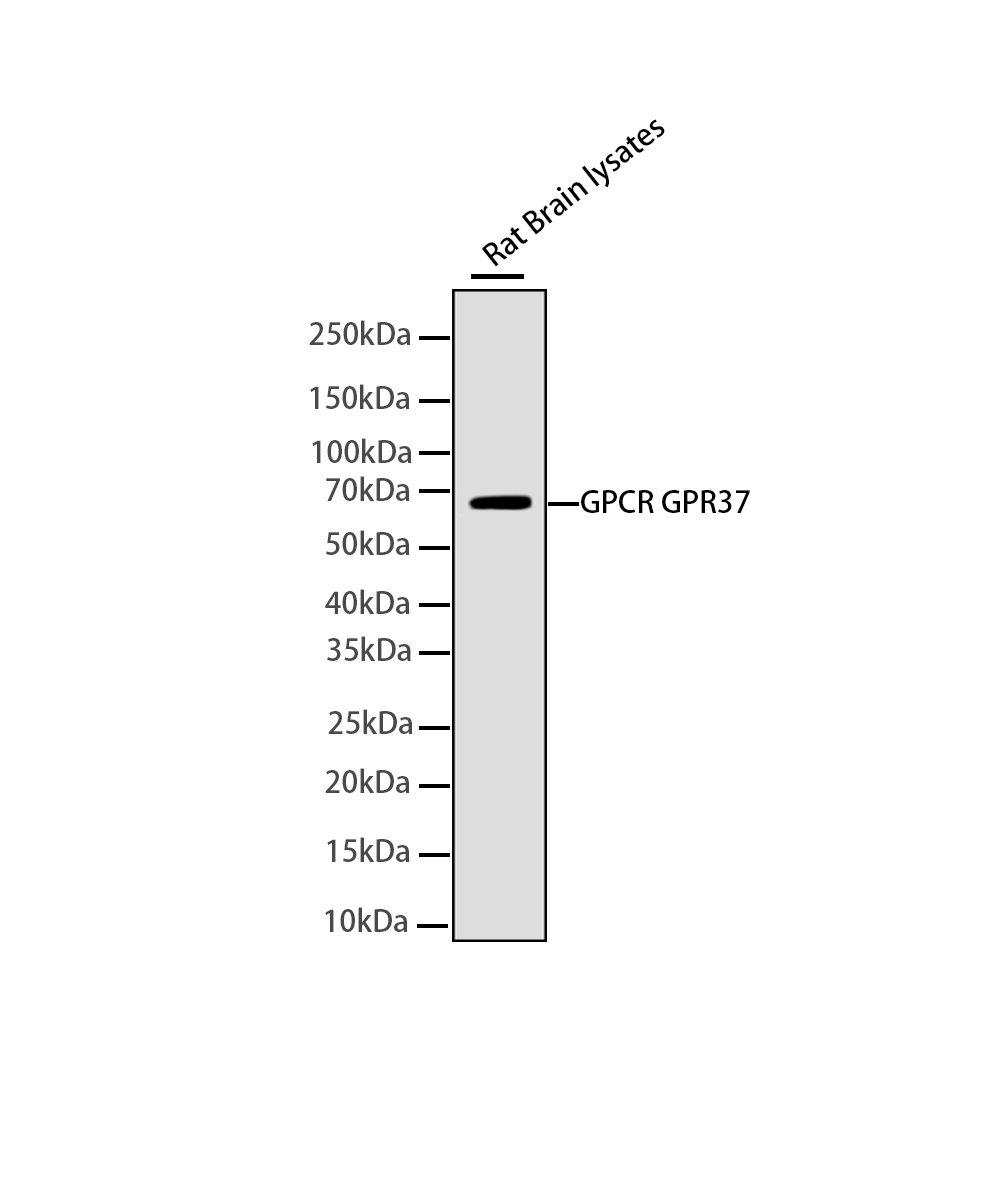 Rabbit monoclonal antibody