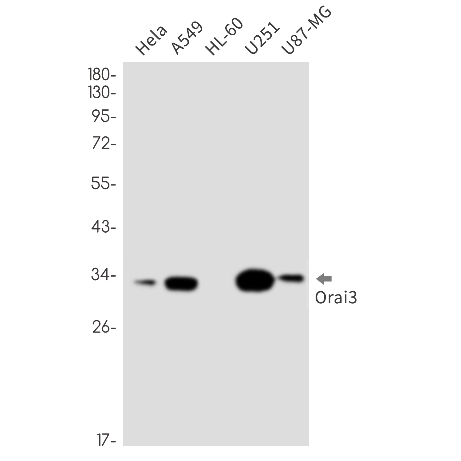 Rabbit monoclonal antibody