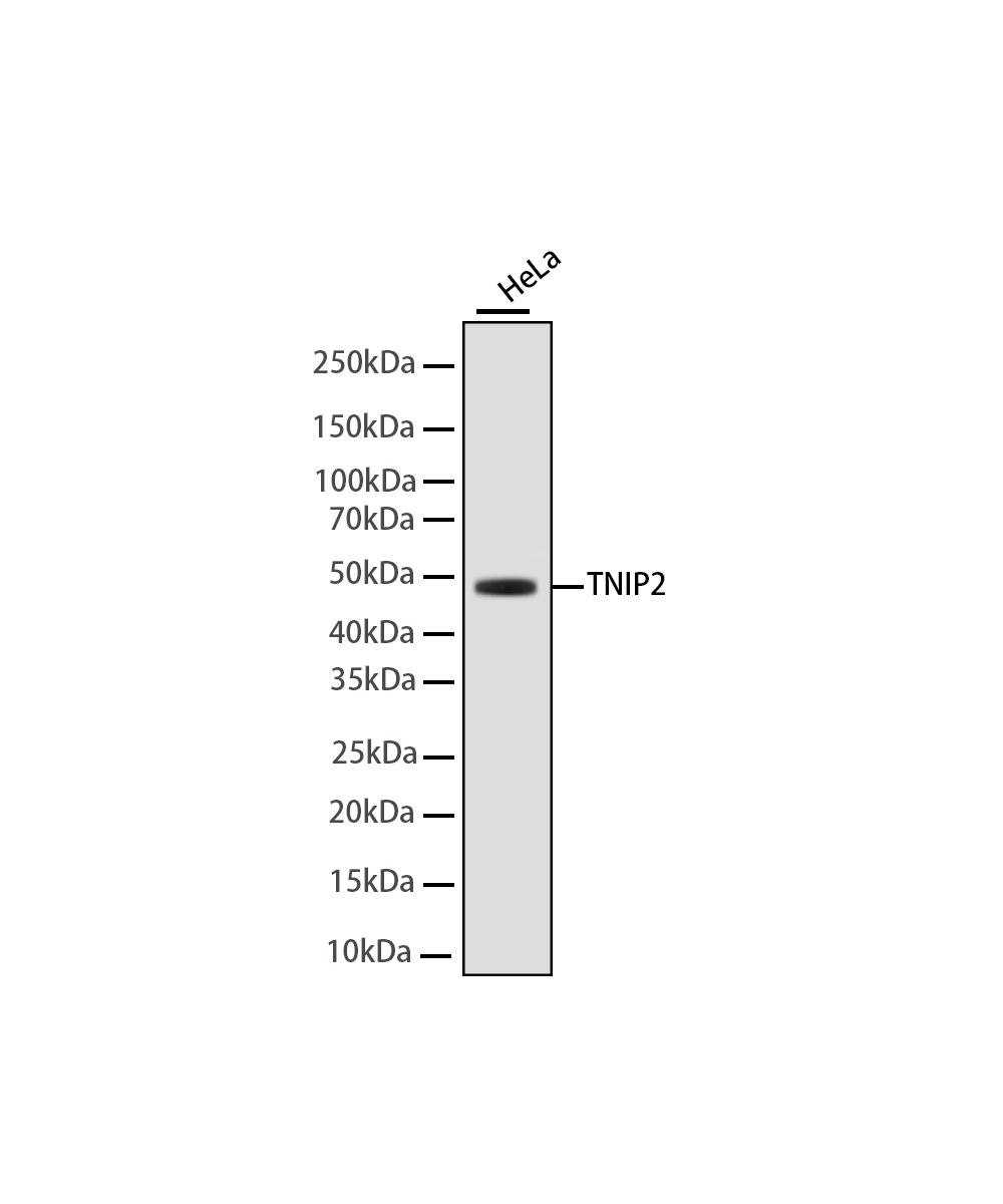 Rabbit monoclonal antibody