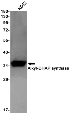 Rabbit monoclonal antibody