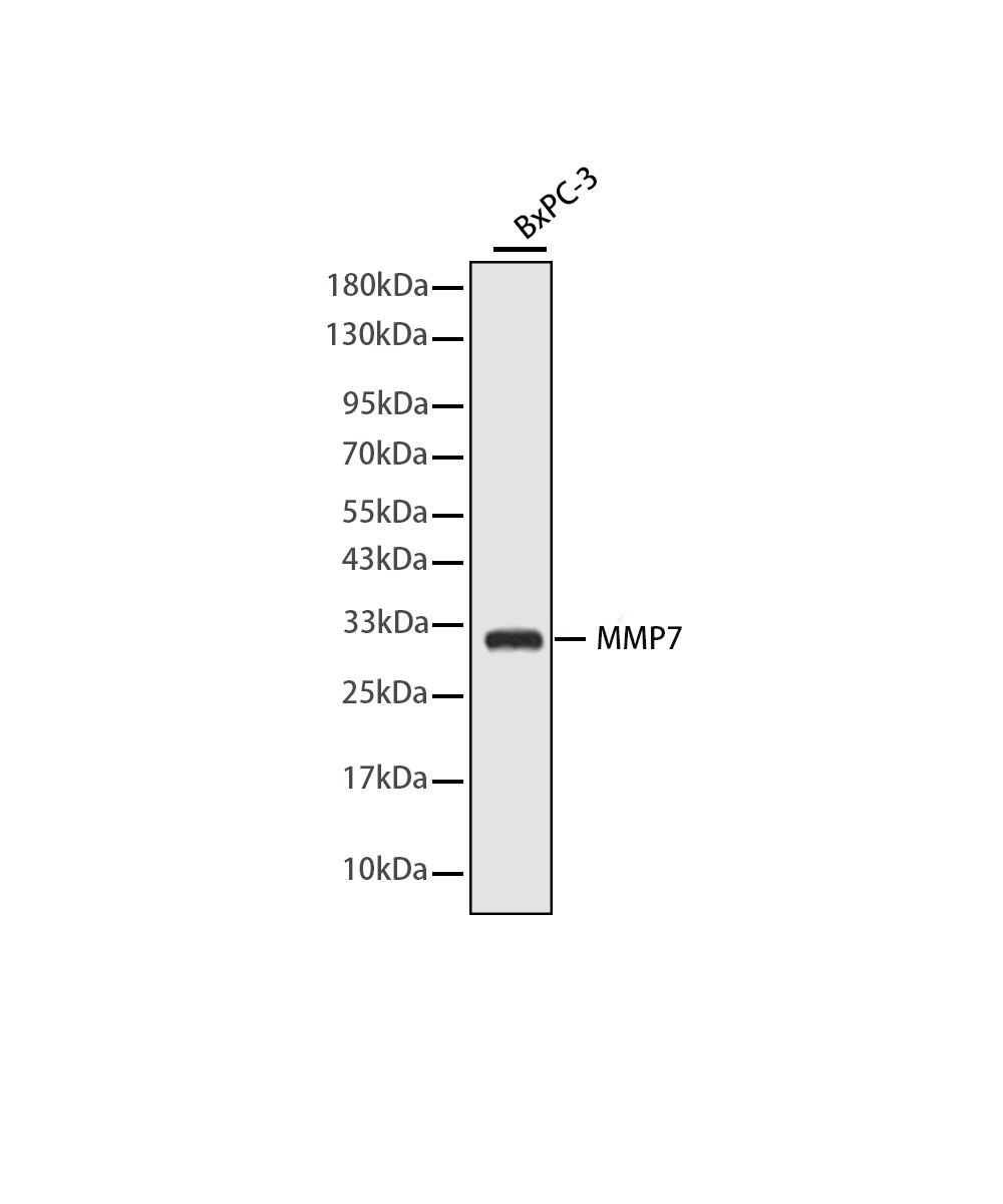 Rabbit monoclonal antibody