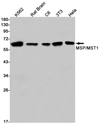 Rabbit monoclonal antibody