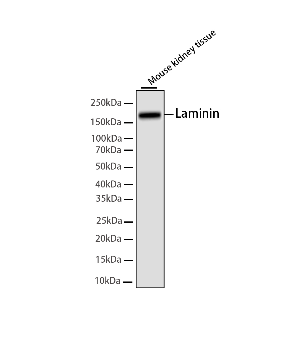 Rabbit monoclonal antibody