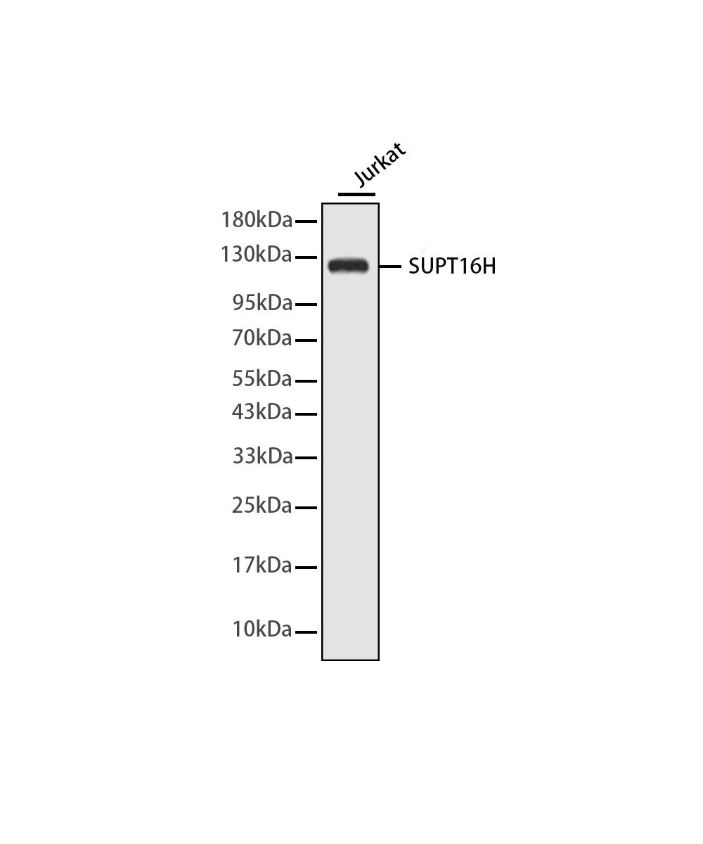 Rabbit monoclonal antibody