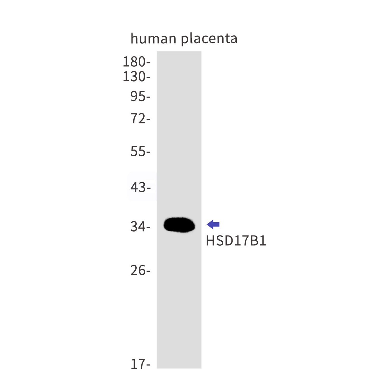 Rabbit monoclonal antibody