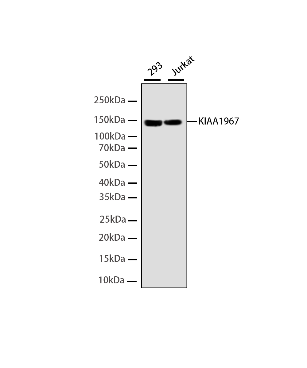 Rabbit monoclonal antibody