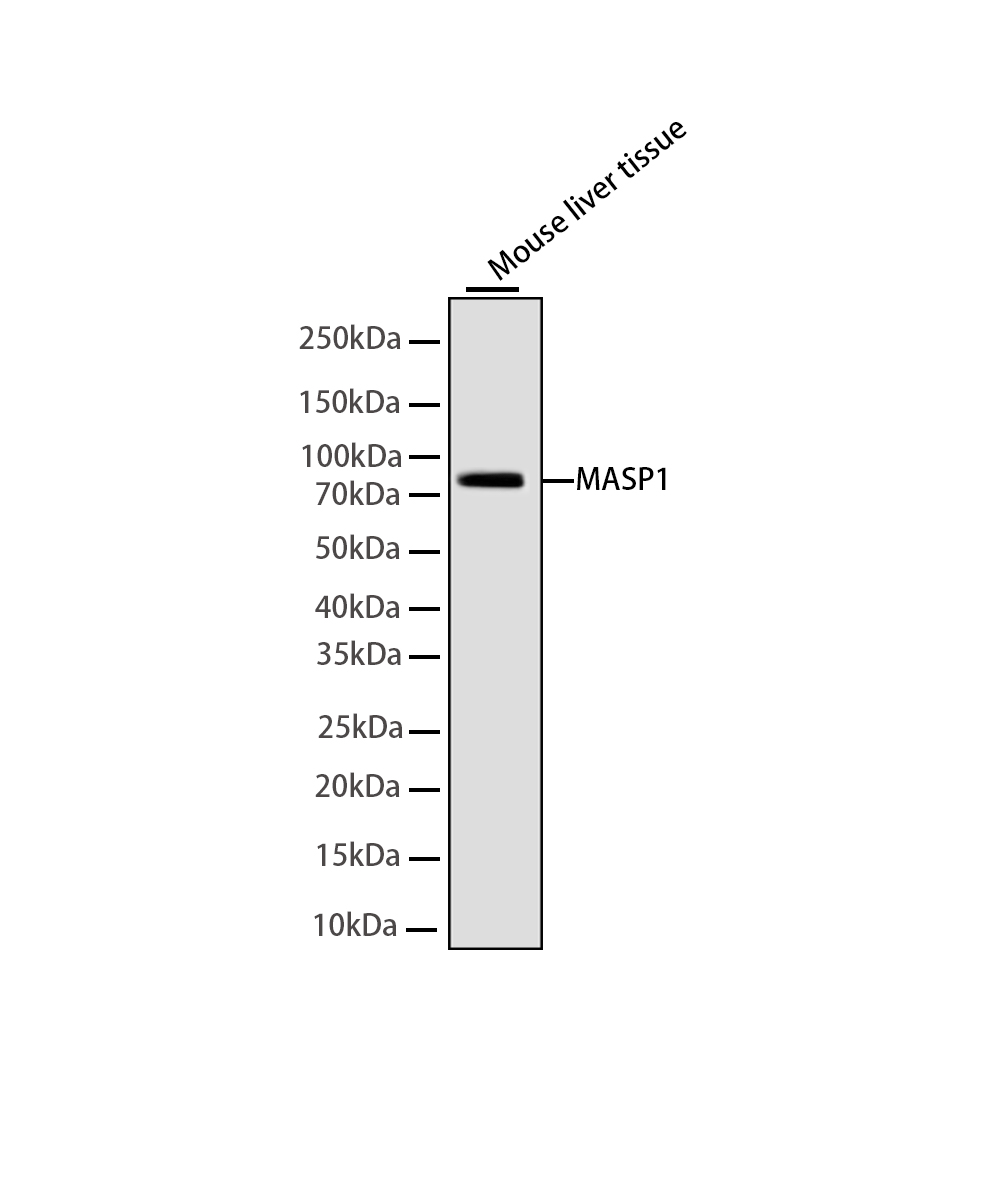 MASP1 Rabbit mAb