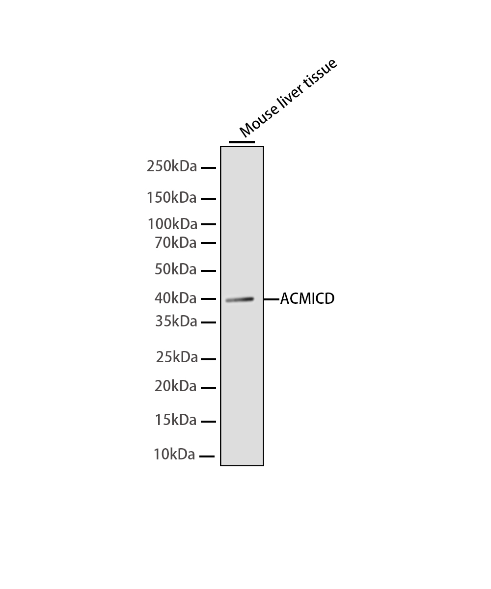 Rabbit monoclonal antibody