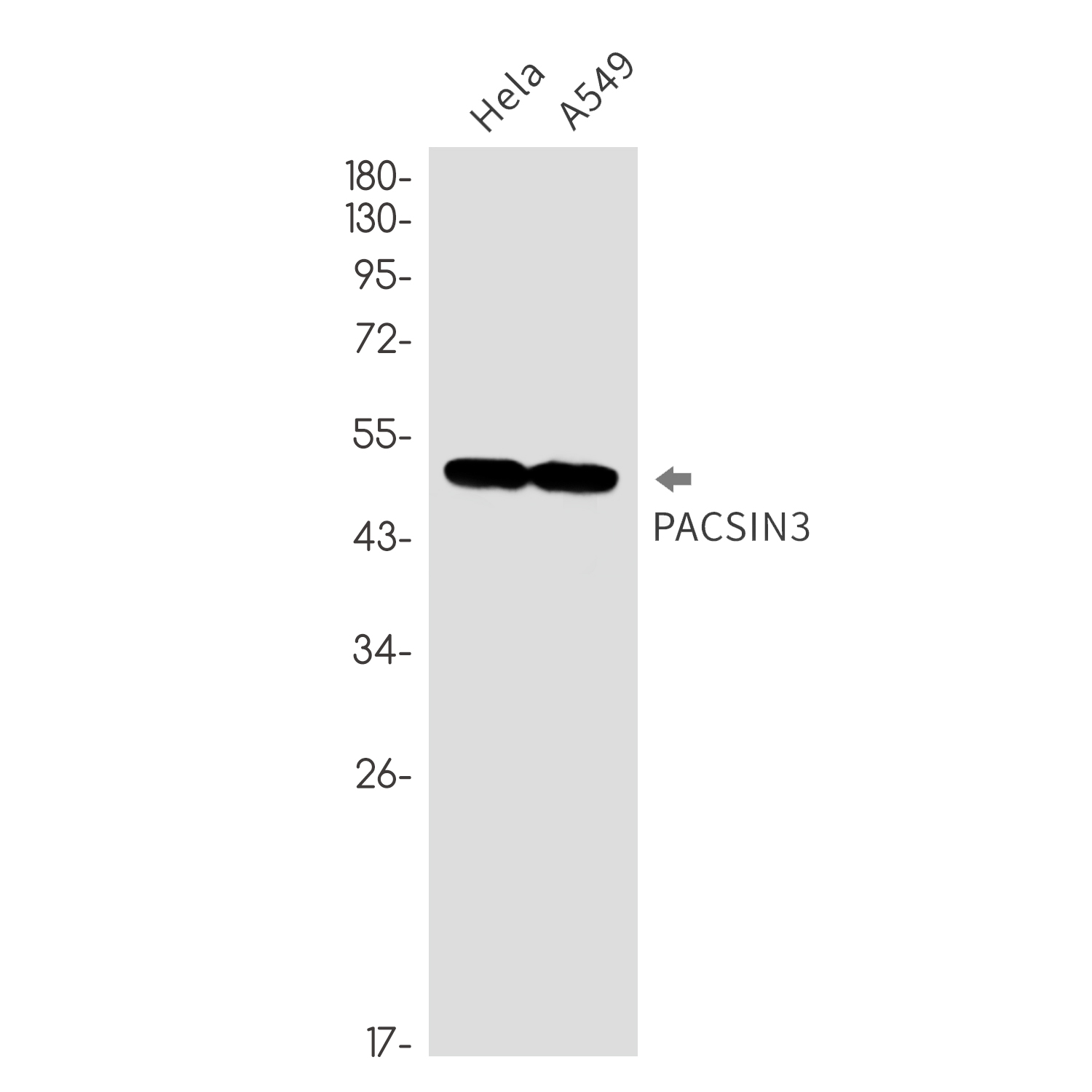 Rabbit monoclonal antibody