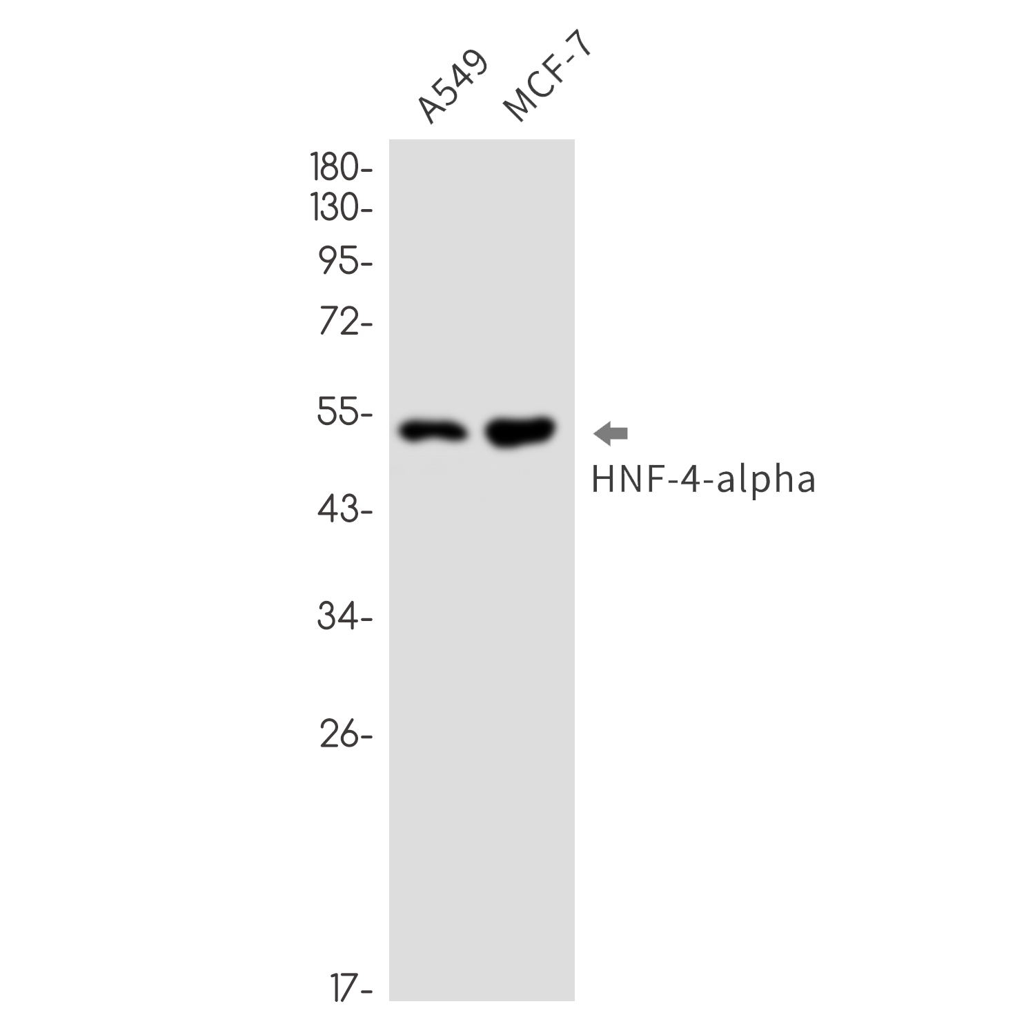 Rabbit monoclonal antibody