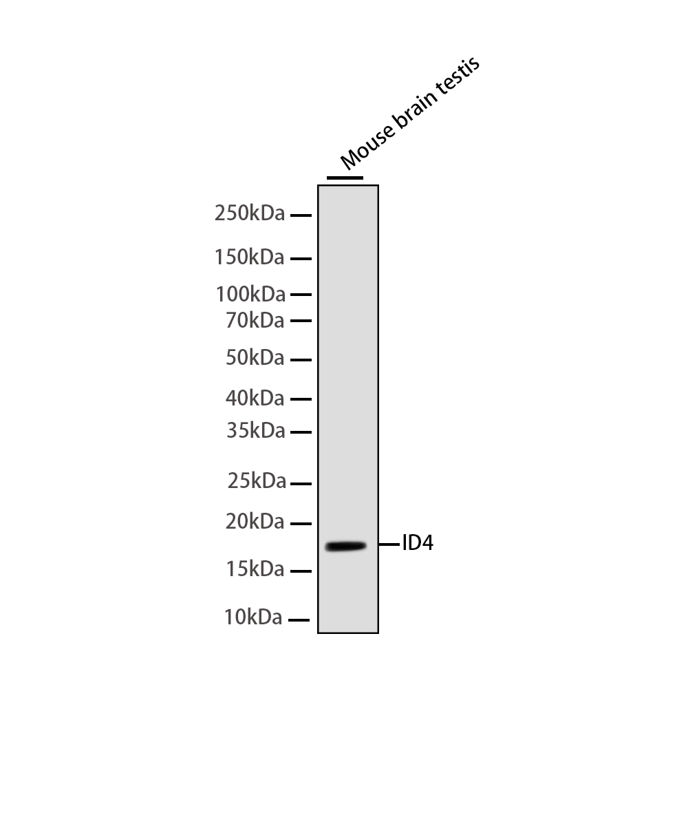 Rabbit monoclonal antibody