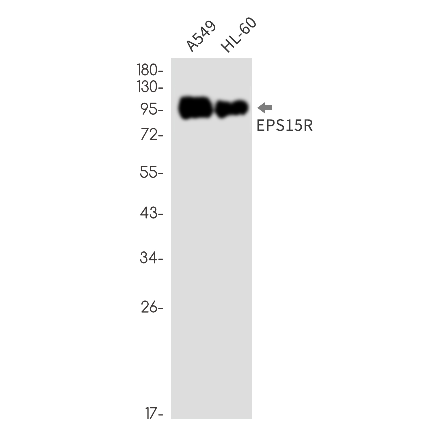 Rabbit monoclonal antibody