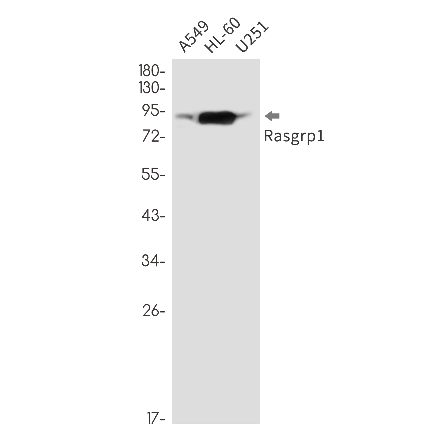 Rabbit monoclonal antibody