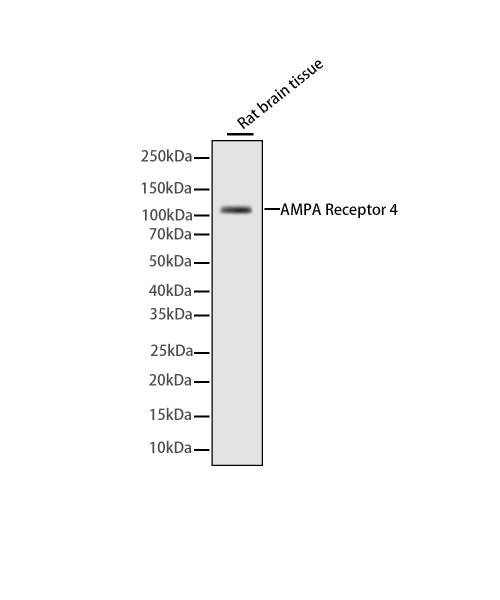 Rabbit monoclonal antibody