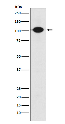 GABA B Receptor 2 Rabbit mAb