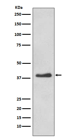 Rabbit monoclonal antibody