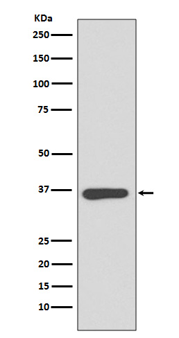 Rabbit monoclonal antibody