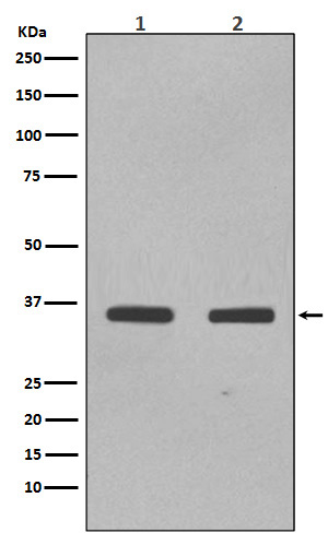 Rabbit monoclonal antibody