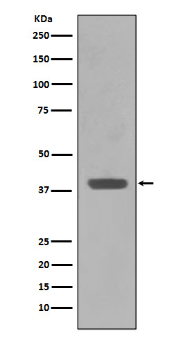 Rabbit monoclonal antibody