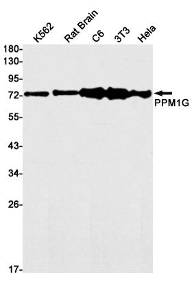 Rabbit monoclonal antibody