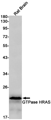 Rabbit monoclonal antibody