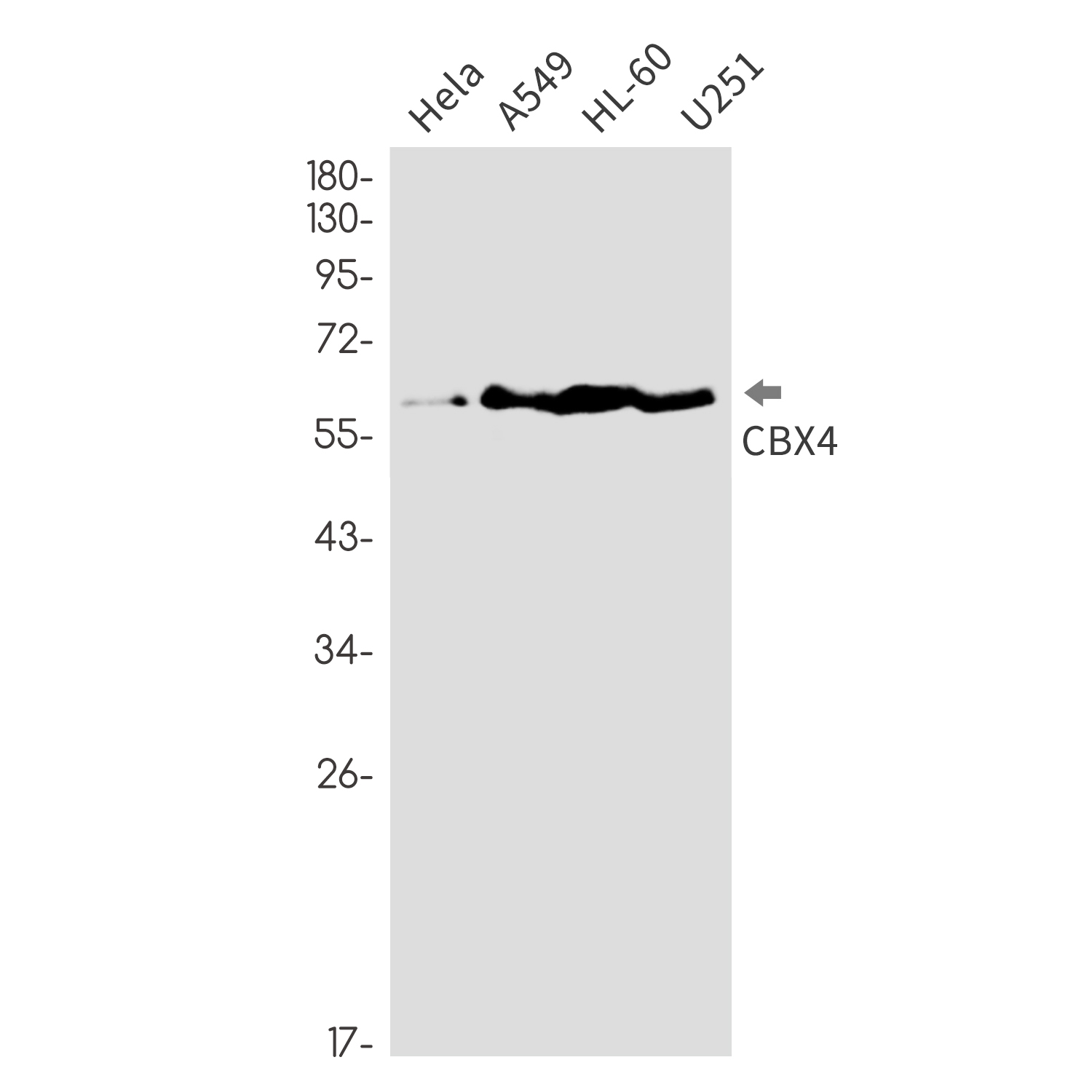 Rabbit monoclonal antibody