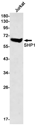 Rabbit monoclonal antibody