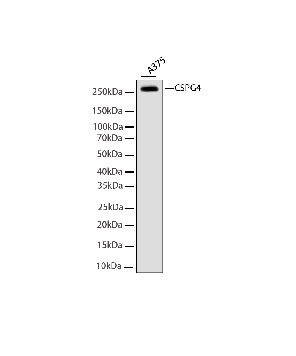 Rabbit monoclonal antibody
