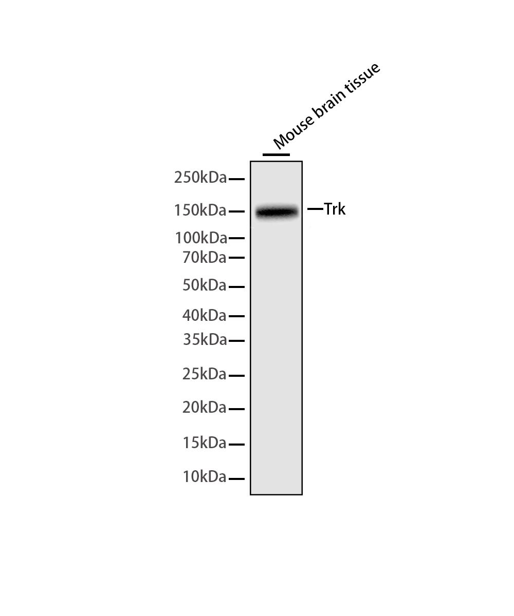 Rabbit monoclonal antibody