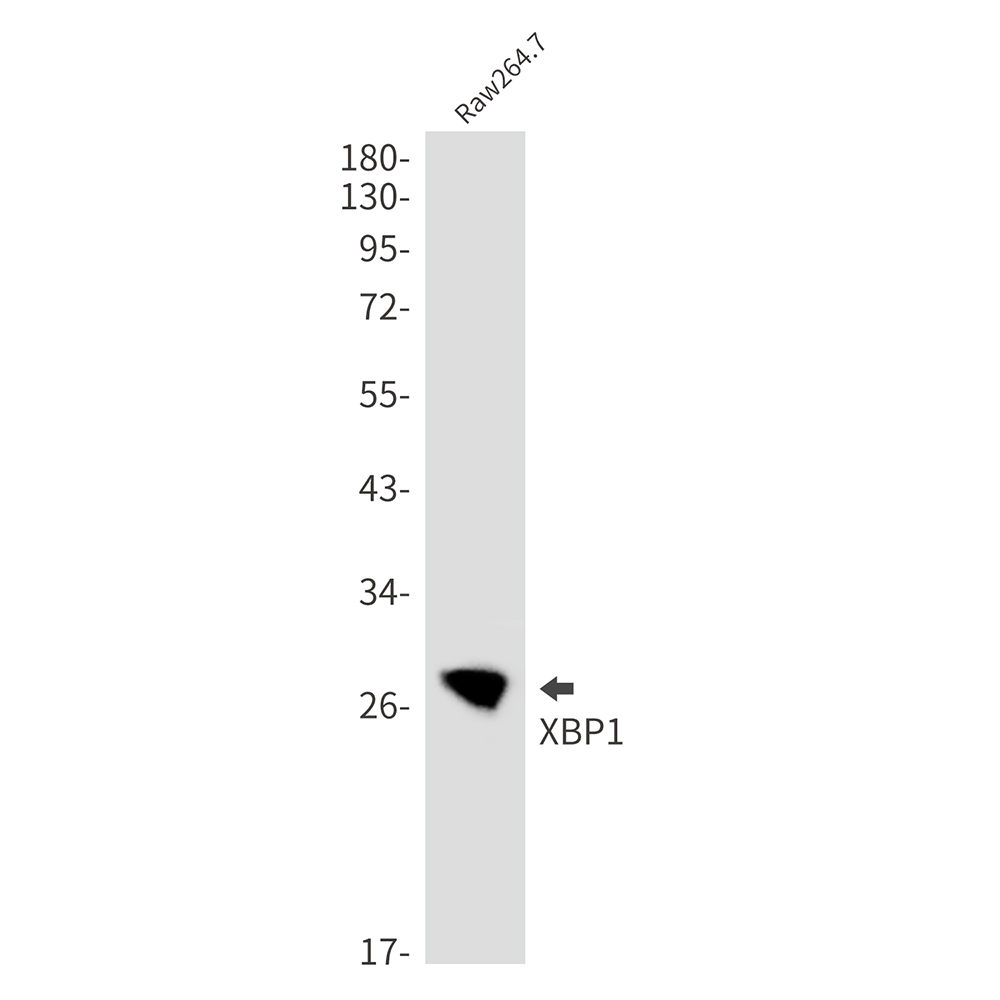 Rabbit monoclonal antibody