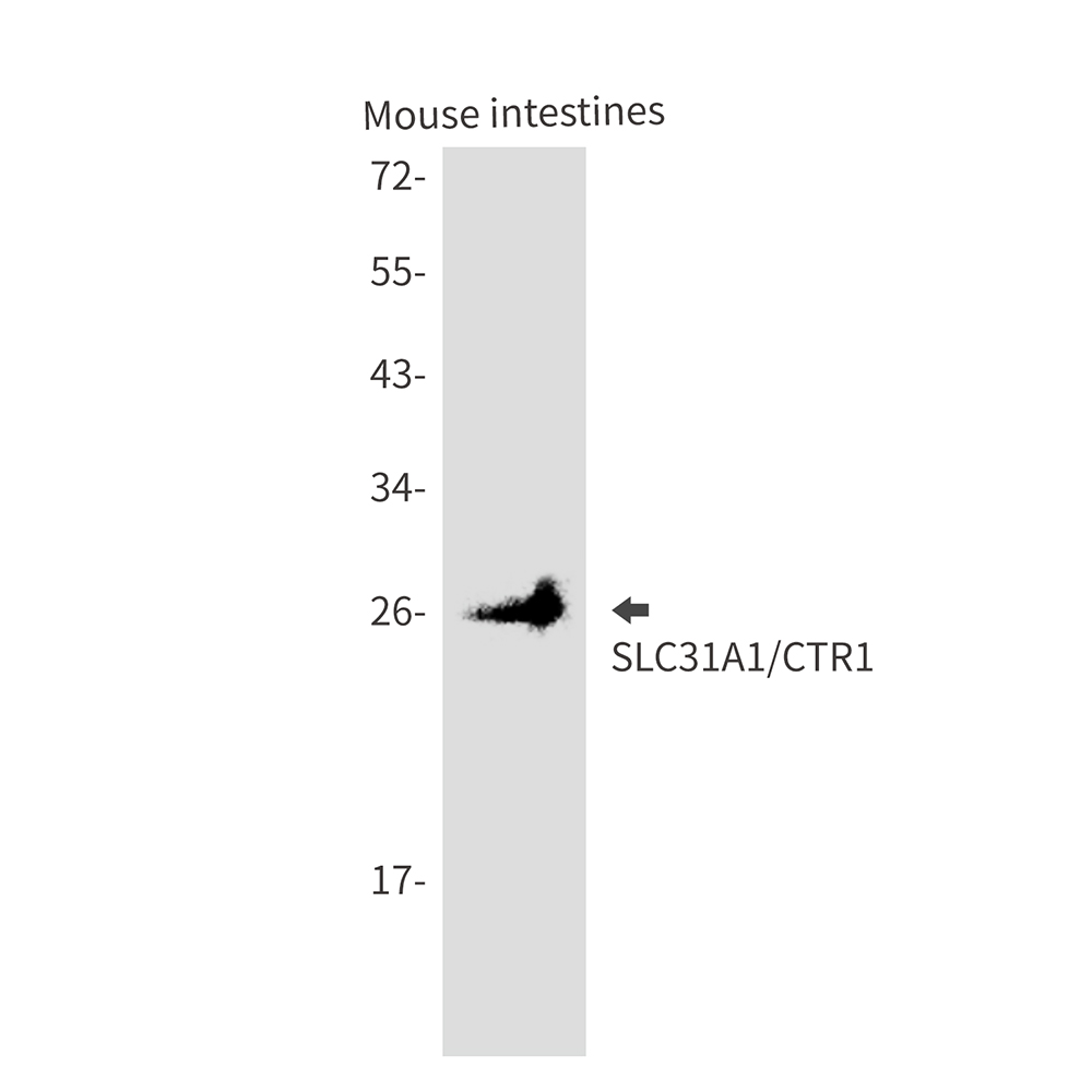Rabbit monoclonal antibody