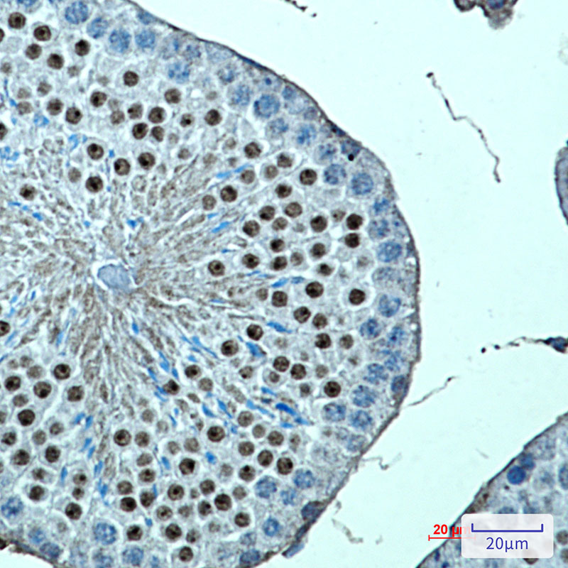 KMT4 Rabbit mAb